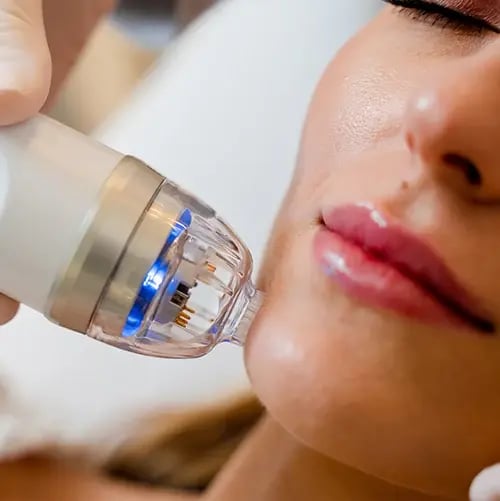 Regionelle - Home - Expert Cosmetic Treatments, Chosen With Intention - Collagen Stimulation copy