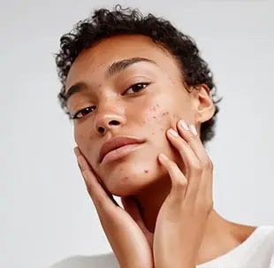 Regionelle - Home - Treatment Benefits - Support Skin Health Over Time copy