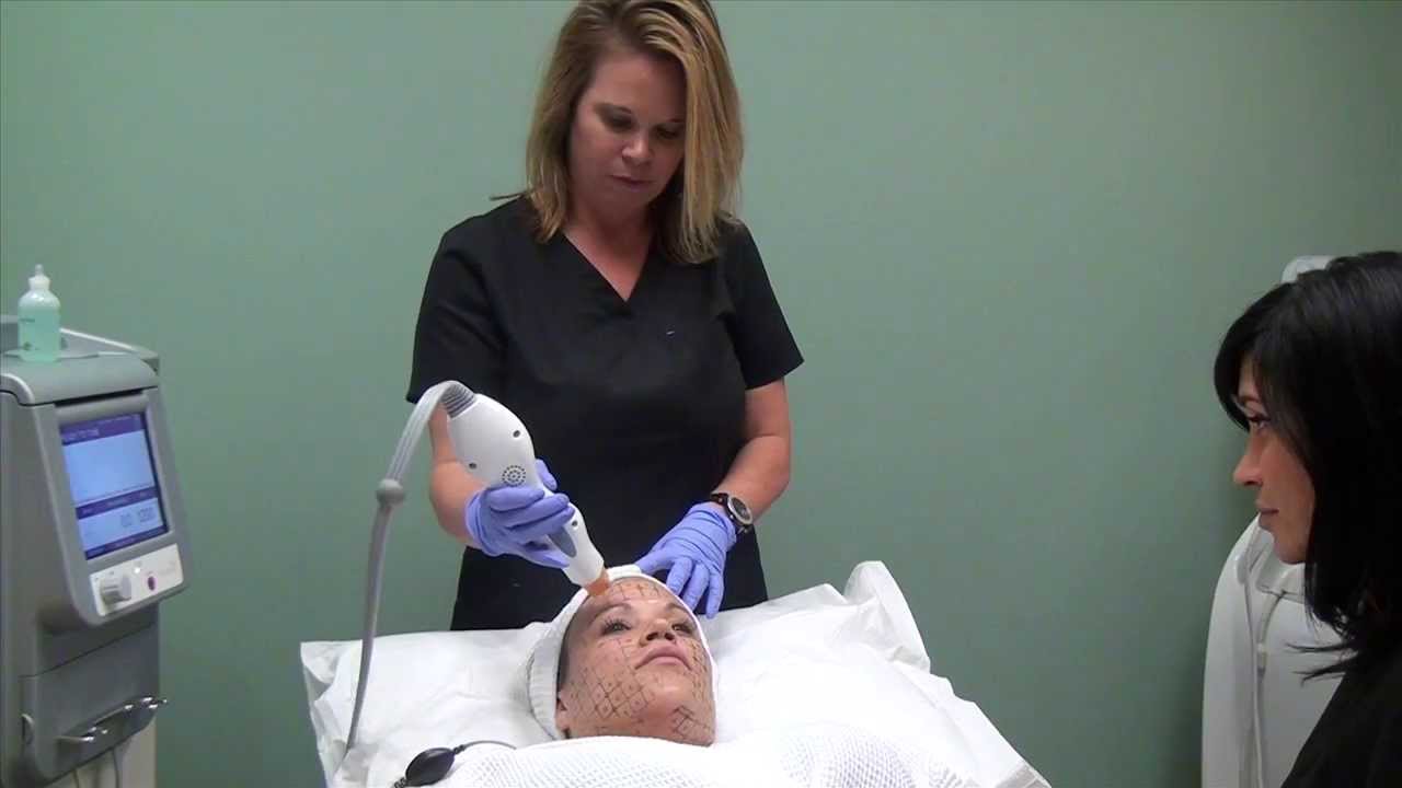 Skin tightening Thermage Regional Skin and Laser Center