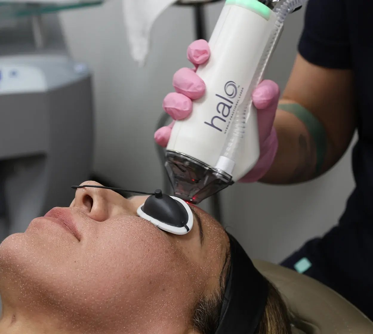 skin resurfacing copy